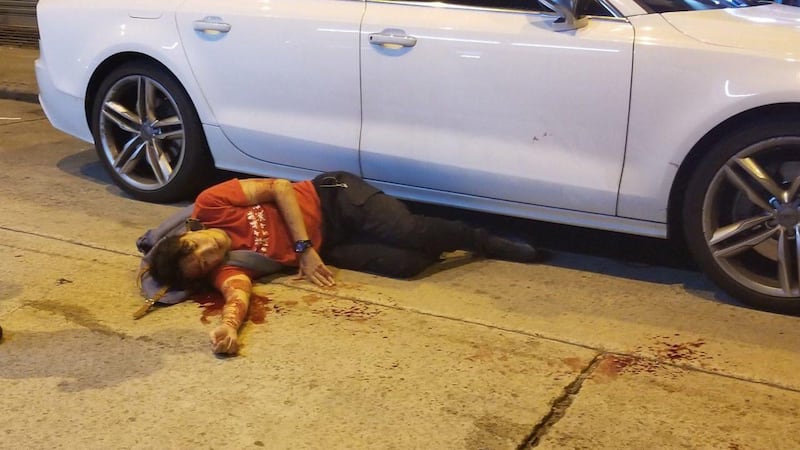 香港“民阵”召集人岑子杰遇袭受伤送医。(脸书图片)