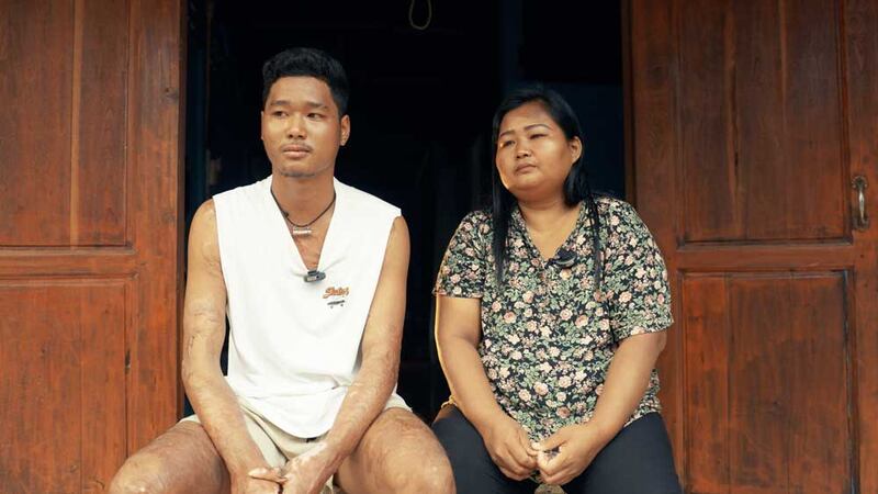 ခန္ဓာကိုယ်တစ်ခုလုံး မီးလောင်ဒဏ်ရာရခဲ့သည့် ကိုဇင်မျိုးဦးကို မိခင်ဖြစ်သူ ဒေါ်နှင်းနှင့်အတူ ထိုင်းနိုင်ငံ မဲဆောက်မြို့တစ်နေရာတွင် ၂၀၂၄ ခုနှစ် ဇူလိုင်လ ၁၈ ရက်နေ့က တွေ့ရစဉ်။ (Chan Aung/ RFA)